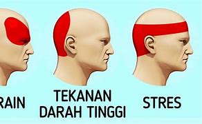 Sakit Kepala Semua Sisi